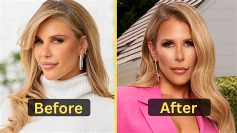 tracy tudor plastic surgery